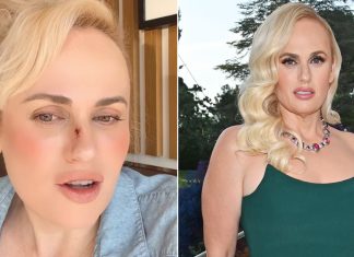 Rebel Wilson acalma os fãs após sofrer lesão durante gravações de novo filme; “Foi um choque”