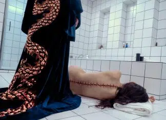 Mulher deitada com cicatriz costurada nas costas.