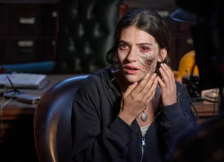 Woman with facial prosthetic scar touching her cheek in a dim, cluttered office.